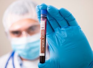 blurred image of a doctor in a mask and gloves holding a hantavirus blood test