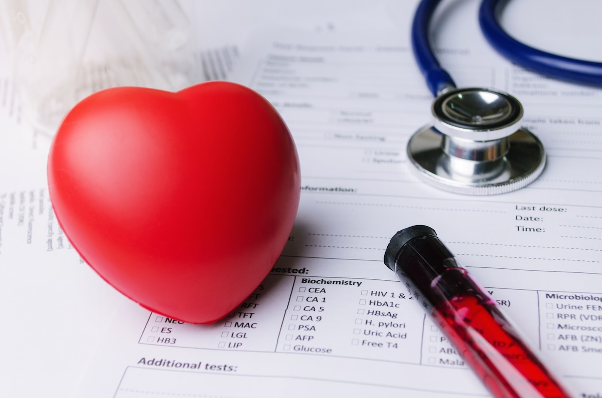 close up of a red heart, stethoscope, test tube, and lab results