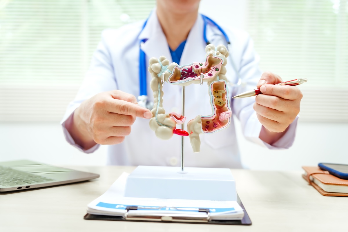 doctor sitting at desk pointing at model of the intestines and colon